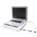 Consec Handheld Human Color Doppler Ultrasonic Diagnostic System Digital Ultrasound Machine CMS1700A